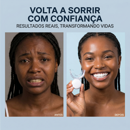 Kit Profissional de Clareador Dental - GlorySmile™